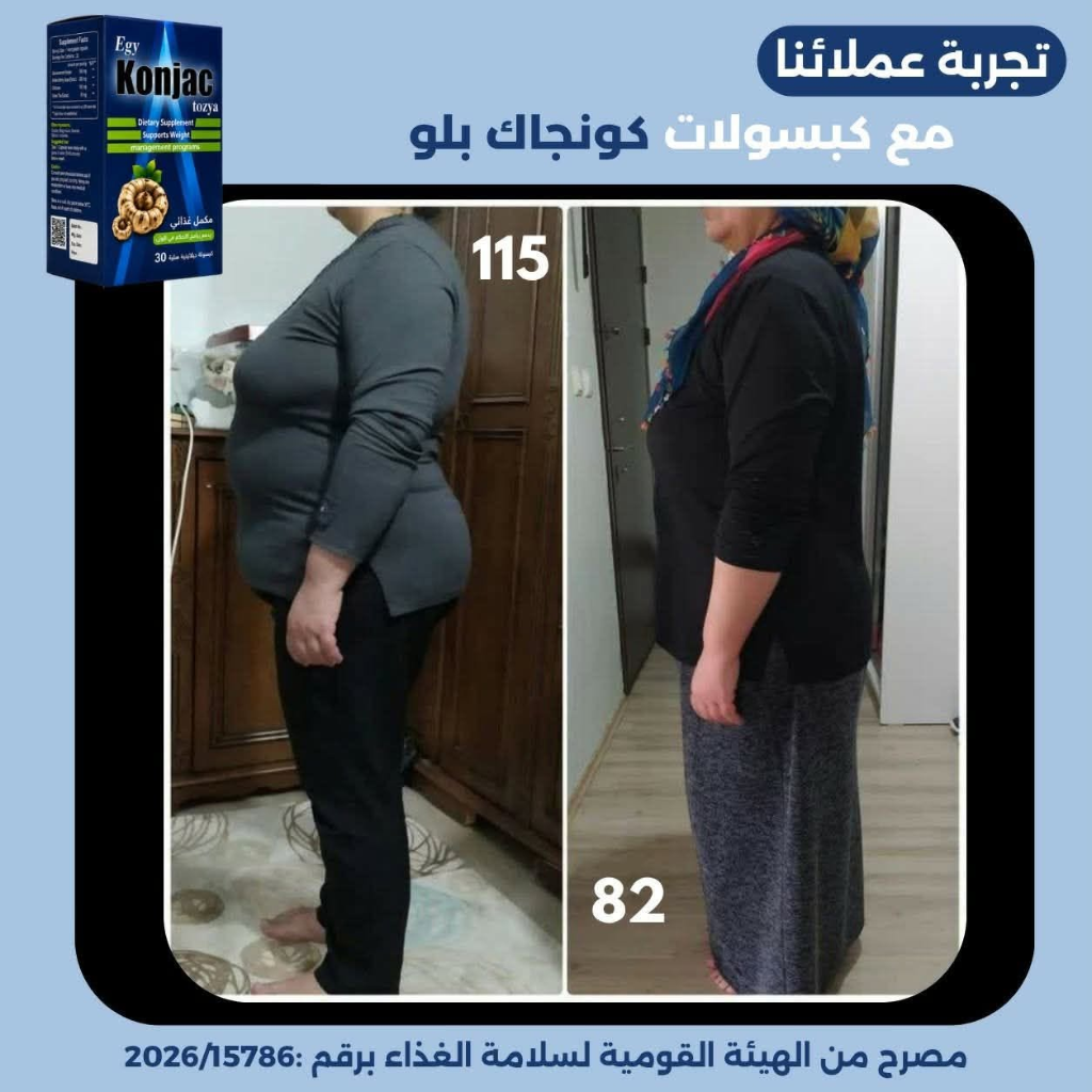 نتيجة قبل وبعد - خسارة 33 كجم كبسولات كونجاك بلو